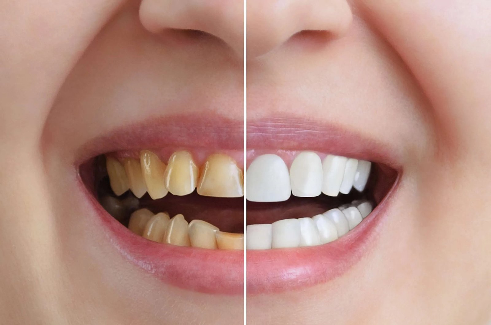 Cosmetic Dentistry in Matthews near Charlotte, NC