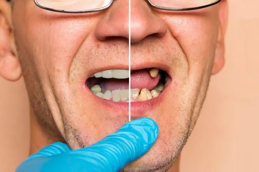 Your #1 dentist and restorative dentistry treatments provider in Matthews, near Charlotte, NC